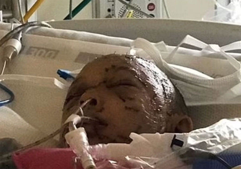 Saklambaç oynarken dağ aslanı saldırdı ölümle burun buruna geldi! - Resim: 4