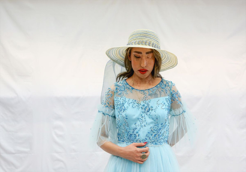 Hepsinin kaderi yüzlerinde saklı... Bu kadın modeller diğerlerinden çok farklı - Resim: 1