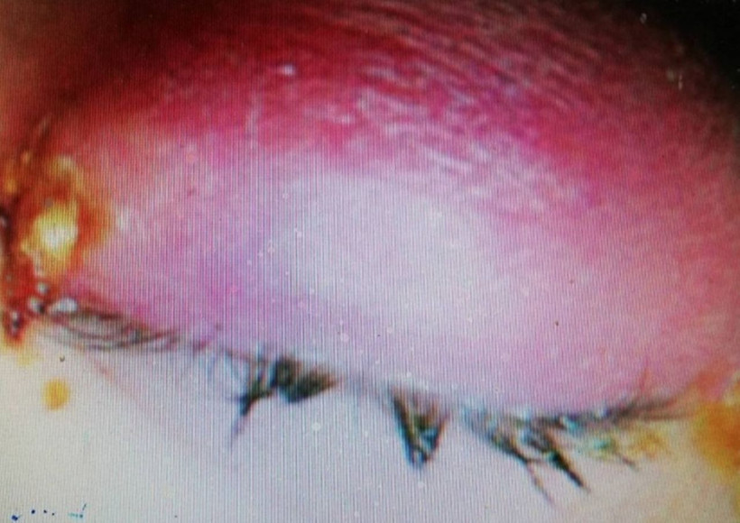 Dünya'da bir ilk arılar gözünde yuva yaptı! - Resim: 2