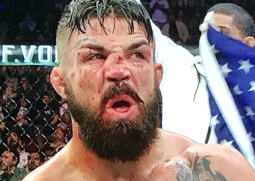 Mike Perry'nin burnu kırıldı suratı tanınmaz hale geldi - Resim: 3