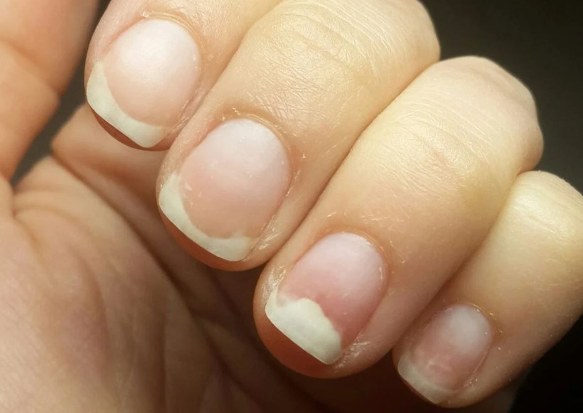 Sağlık durumu tırnaklara bakarak anlaşılır mı işte yanıtı! - Resim: 2