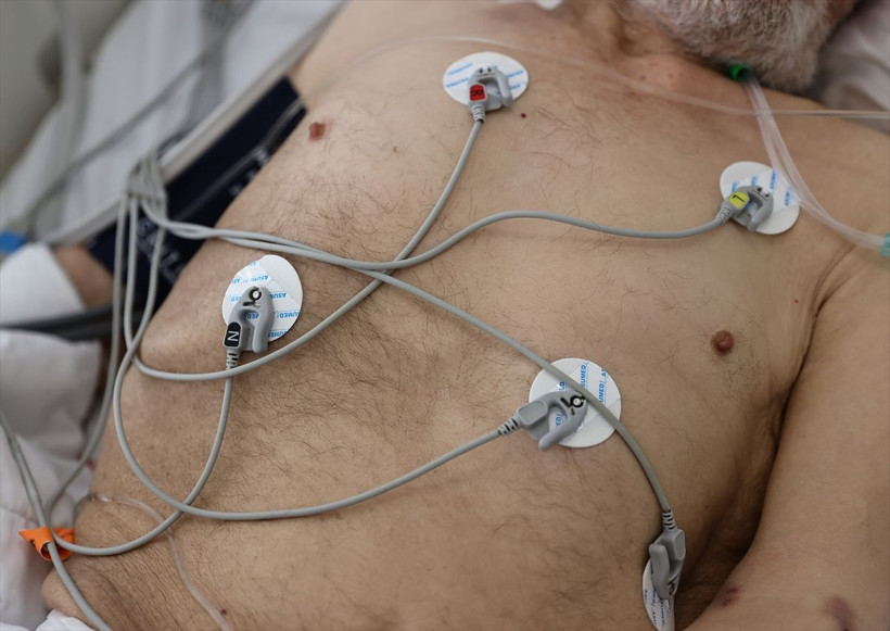 Ankara Şehir Hastanesi koronavirüs yoğun bakım ünitesi kapılarını açtı - Resim: 4