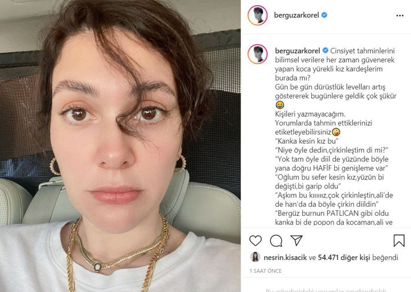 Bergüzar Korel'den olay hamilelik ve cinsiyet tahmini paylaşımı: Burnum ve popom kocaman! - Resim: 1