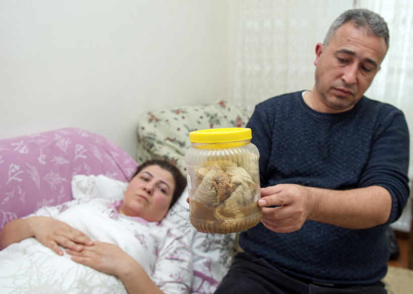 Kanser olabilirsin denildi, karnından çıkanlar şoke etti - Resim: 4