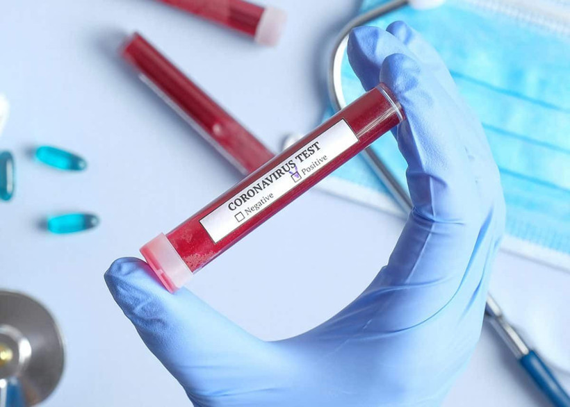 Koronavirüs ilacı üretildi virüs etkisiz hale getirildi sevindiren müjde Belçika'dan geldi - Resim: 1