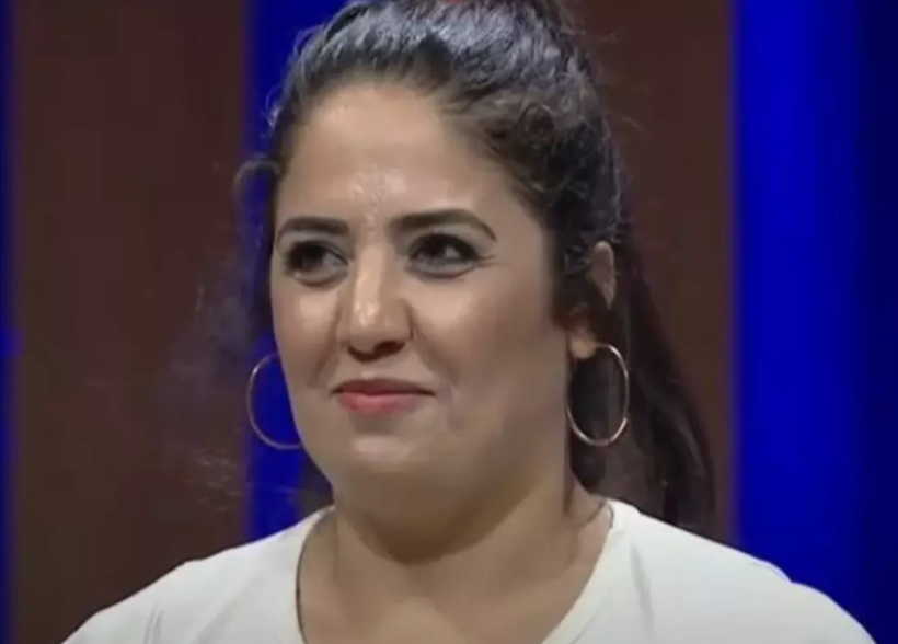 Eski MasterChef yarışmacısı Azize Polat estetikle bambaşka biri oldu! Son halini görenler çok şaşırdı - Resim: 2