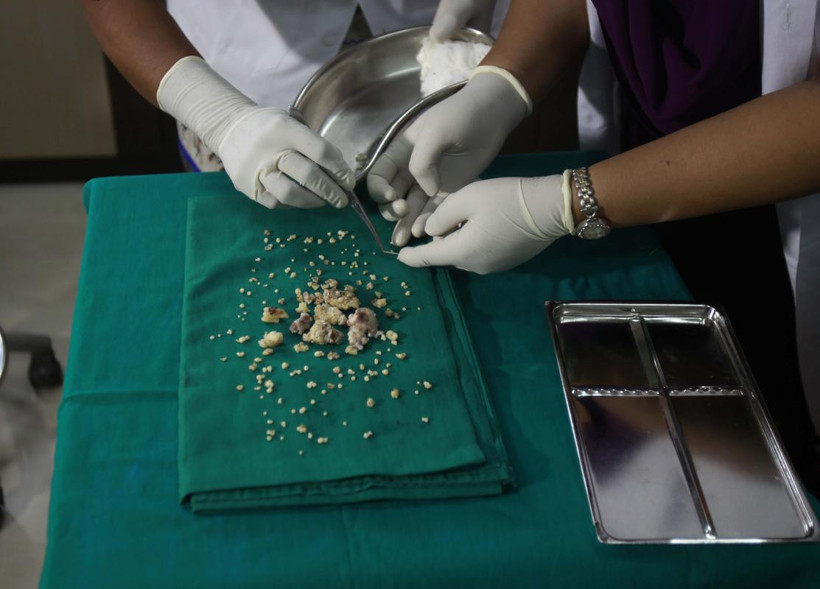 Çenesinden tam 232 diş çekildi - Resim: 4