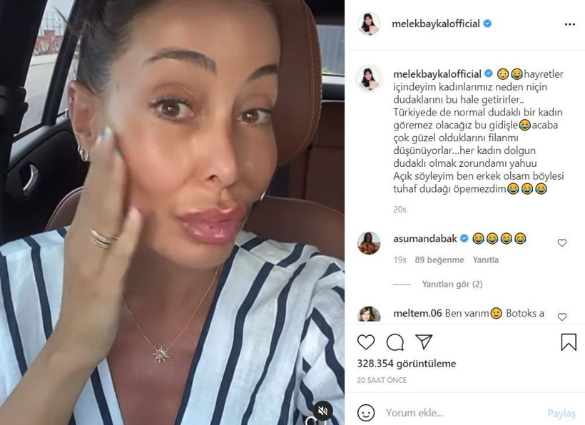 Melek Baykal'dan estetik ve dolgu dudak videosu! Serap Paköz çok kızacak! - Resim: 2