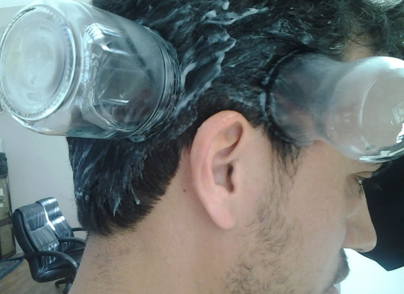 'Migren hastalığında ameliyat, sülük, hacamat tedavisinin yeri yok' - Resim: 2