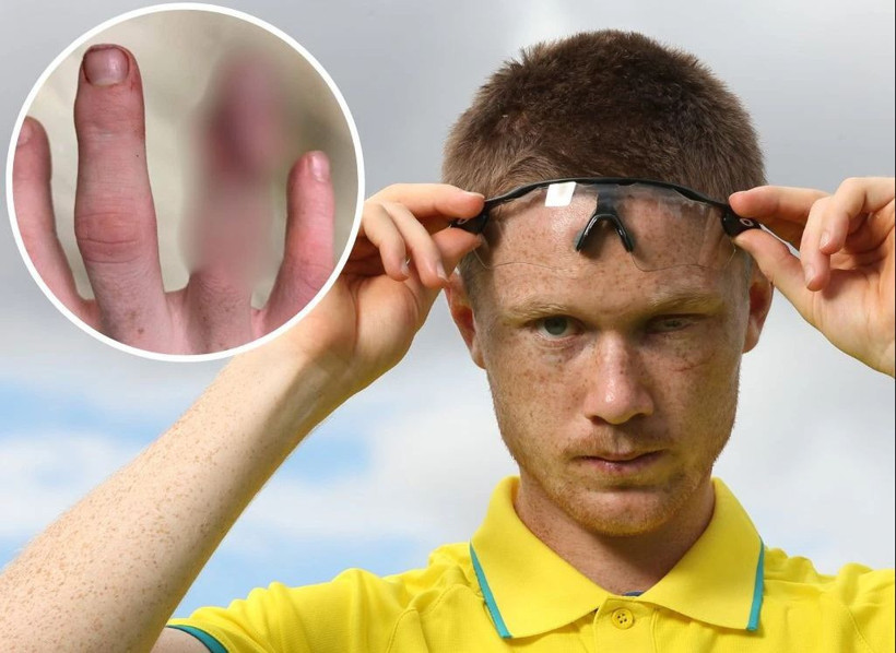 Avustralyalı hokey oyuncusu olimpiyatlarda oynayabilmek için parmağını kesti - Resim: 4