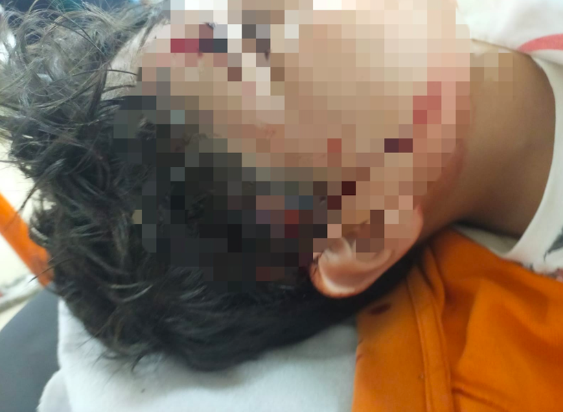 Bursa'da okula giderken 8 köpek saldırdı 80 dikiş atıldı bir motosikletli dalıp kurtardı - Resim: 1