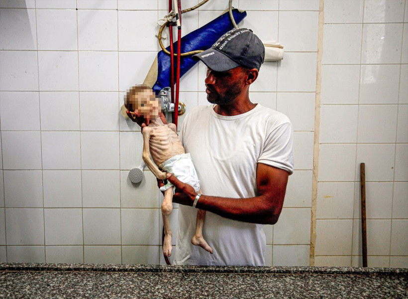 Gazze'de vicdanları sızlatan görüntü! 7 aylık bebek, yetersiz beslenme nedeniyle yaşamını yitirdi - Resim: 2