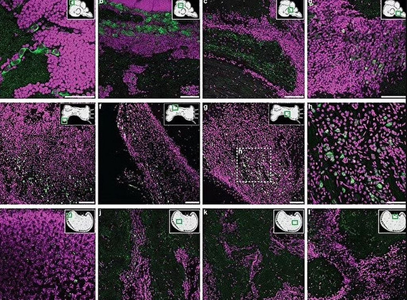 Ahtapot ve insanlar arasında şok eden benzerlik! - Resim: 1