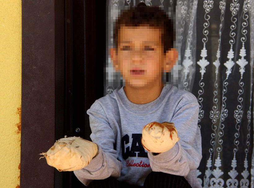 Küçük çocuğu yemek bile yiyemeyecek hale getirdi - Resim: 2