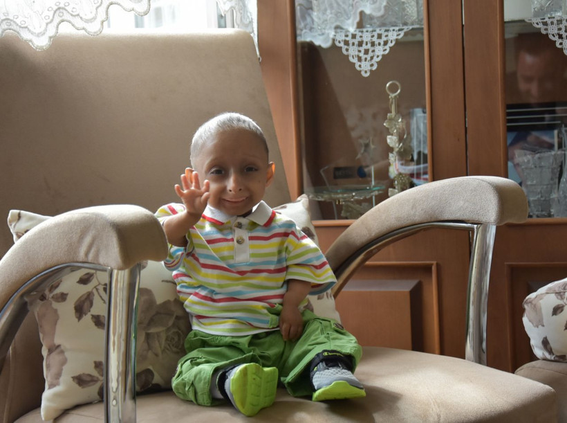 Hastalığı milyonda bir görülüyor gerçek yaşını duyan şaşkına dönüyor - Resim: 3