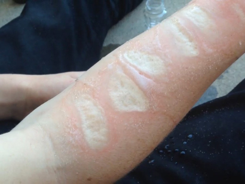 Bu nasıl akım! Vücutlarını delik deşik ediyorlar tuz ve buz... - Resim: 1