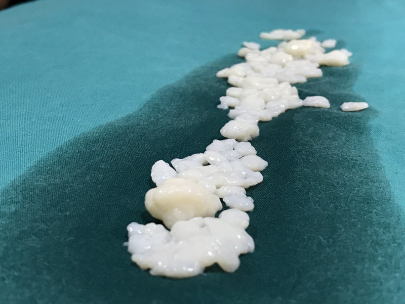 Dizinden 967 adet eklem faresi çıktı! - Resim: 4