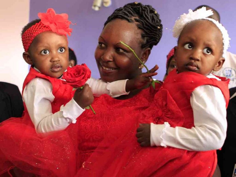 İkizlerin hayatı için büyük mucize tam 50 doktor... - Resim: 2