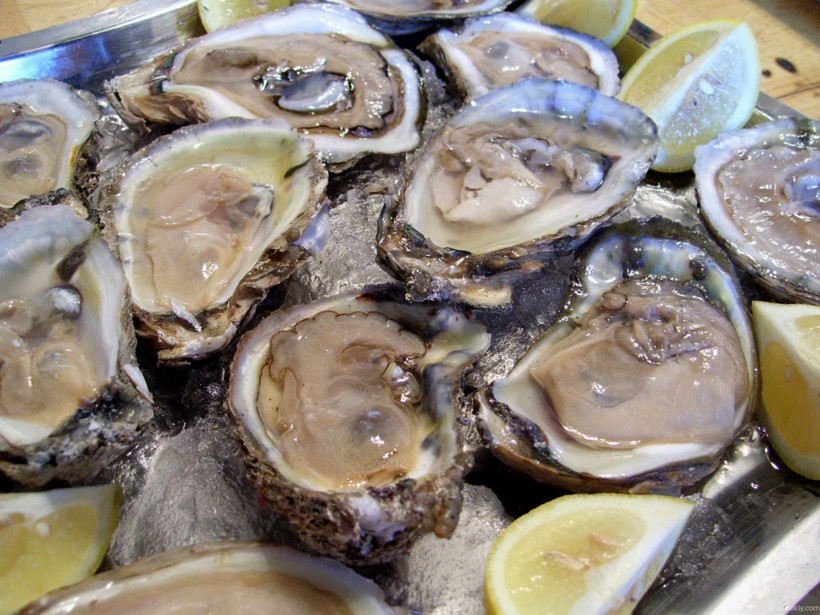 Severek yiyordu ölümüne neden oldu - Resim: 3
