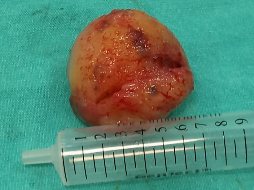 Baş dönmesi nedeniyle hastaneye gitti kalbinden çıkanlar şaşkına çevirdi - Resim: 3