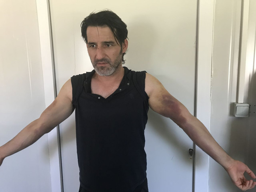 Plastik mermi elektrikli şok cihazları.... Dövüp Meriç Nehri'ne attılar! - Resim: 3