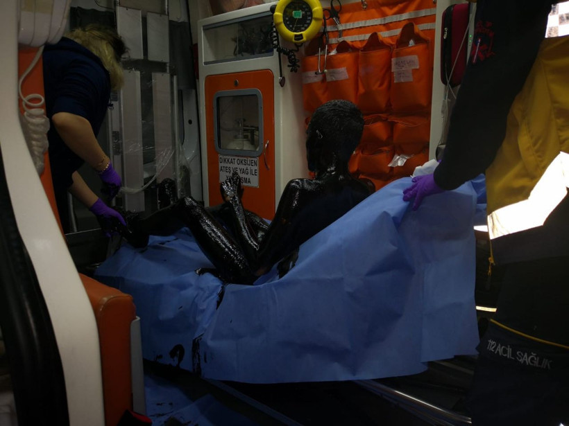 Günün kahramanı oldu! Kediyi kurtarmak için petrol dolu kuyuya girdi - Resim: 1