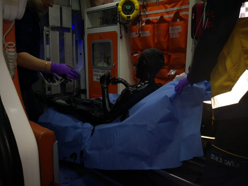 Günün kahramanı oldu! Kediyi kurtarmak için petrol dolu kuyuya girdi - Resim: 2