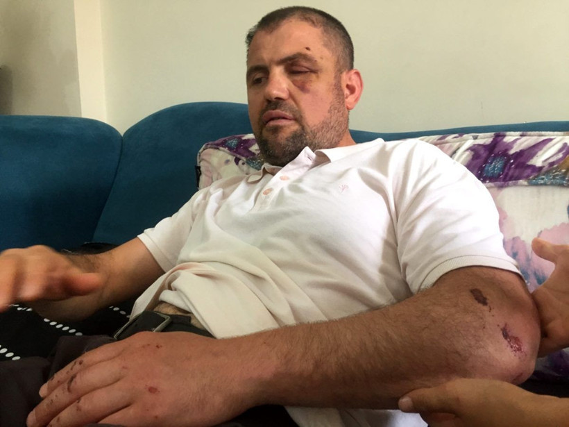 Bursa'da gazinin dövülmesine ilişkin davada 2 kişi tahliye edildi - Resim: 1