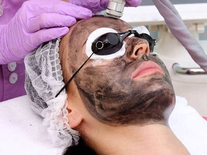 Karbon peeling nedir nasıl yapılır en derin cilt lekeleri bile yok oluyor! - Resim: 2