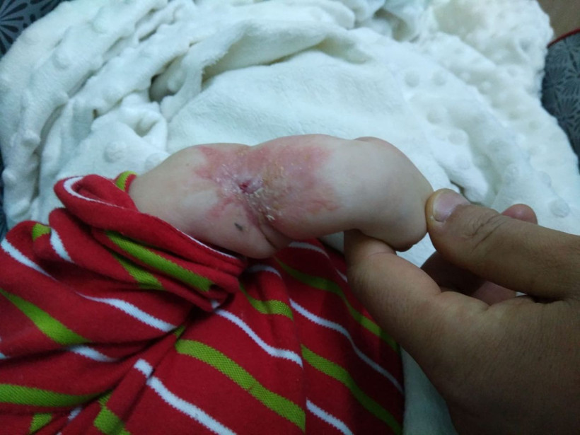 Bursa'da İsa bebeğin kolundaki yaranın sebebi bulunamıyor - Resim: 4