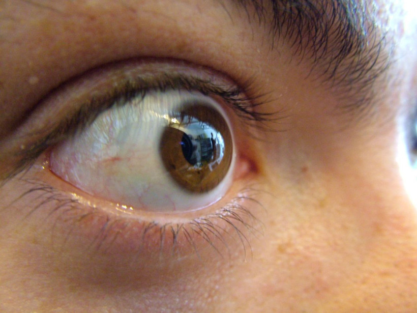 Corona virüsle mücadelede önemli uyarılar! Gözlere dikkat edin - Resim: 1