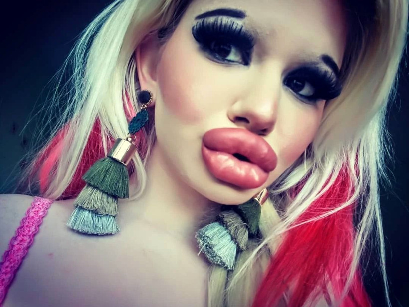 22 yaşındaki kız oyuncak Barbie'ye özenip bu hale geldi! - Resim: 1