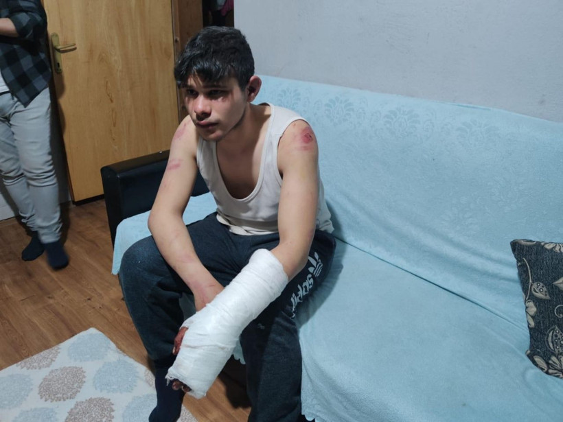 Afyonkarahisar'da 5 saat dövdüler Nazi işkenceleri aratmadı! Sebebi ise şok etti - Resim: 2