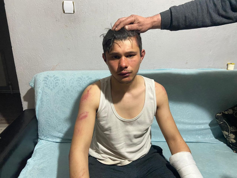 Afyonkarahisar'da 5 saat dövdüler Nazi işkenceleri aratmadı! Sebebi ise şok etti - Resim: 3