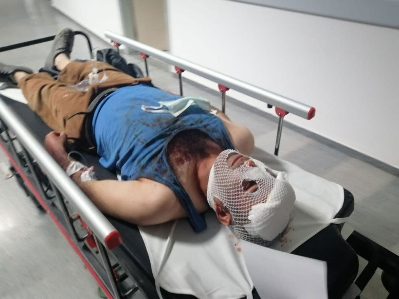 Aksaray'da 15 yaşındaki çocuğu kaçırmak için evi bastılar! Yaralılar var - Resim: 4