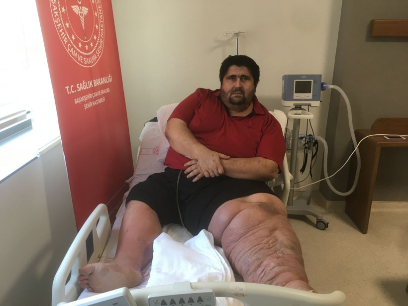 8 yıl önce öğrendi 300 kiloya çıktı! Gözyaşlarıyla anlattı: En büyük hayali... - Resim: 2