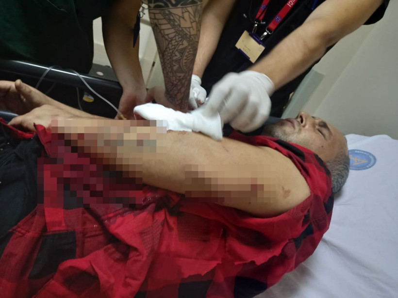 Antalya'da markette korkunç olay! 'Yüzünü komple parçaladı, kulağı sallanıyordu' - Resim: 4