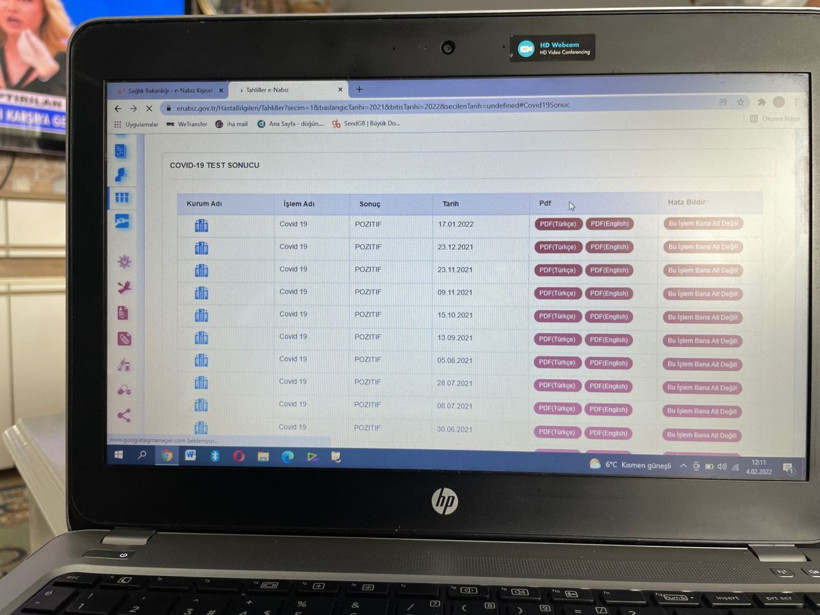 78 covid-19 testi pozitif çıktı 14 aydır karantinada! Hayatı kabusa döndü: Dışarıdan kedi geçse bana... - Resim: 2