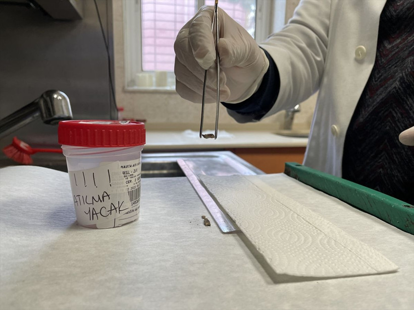 İzmir'de kanser sanılan hastanın soluk borusundan bakın ne çıktı - Resim: 4