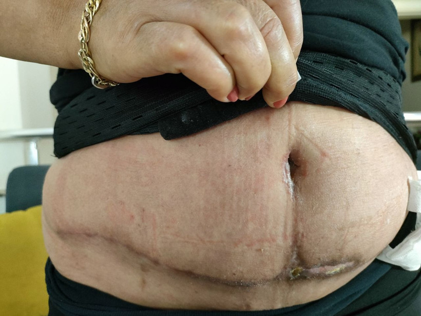 Bankadan kredi çekip güzelleşmeye gitti vücudu haritaya döndü! Kasap gibi kesip biçti - Resim: 3