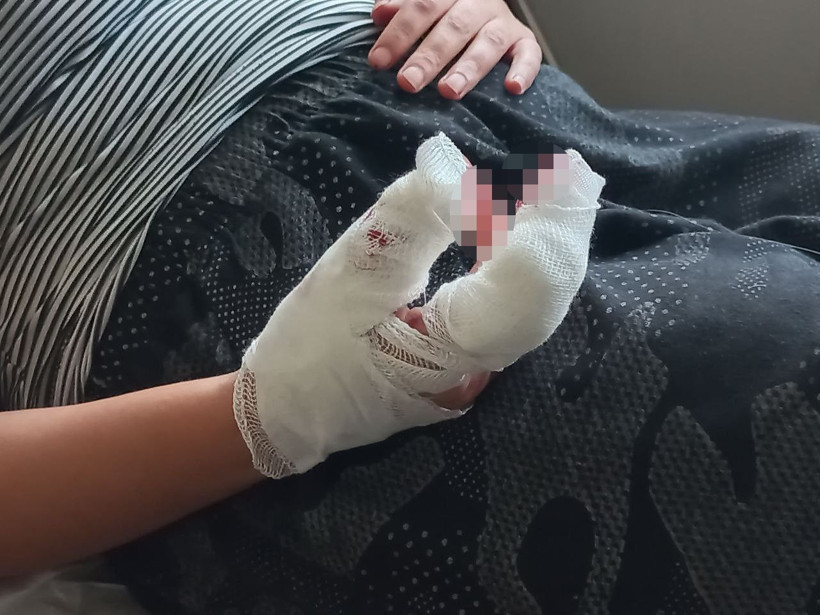 Koca dehşeti! Öyle şeyler yaptı ki parmağım kopuk, burnum ve dişim kırık! - Resim: 4