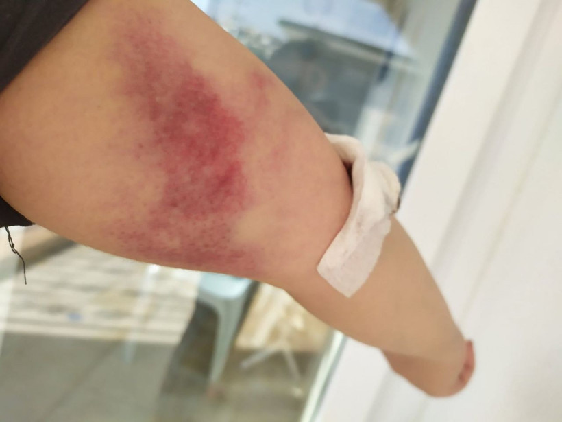 'Göğsüme tırnaklarını geçirdi' deyip tacizi anlattı! Ceren ve sevgilisi davalık oldu - Resim: 3