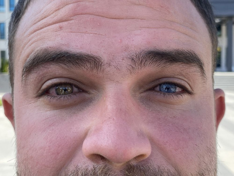 Hepsinin aynı bir onun böyle! Gözlerine bakan inanamıyor - Resim: 1