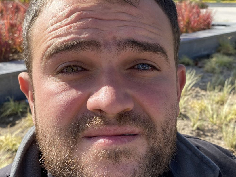 Hepsinin aynı bir onun böyle! Gözlerine bakan inanamıyor - Resim: 2