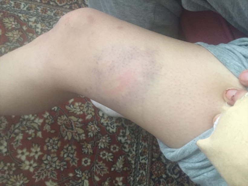 İşkence çiftliği! Günlerce döve döve tecavüz edip zorla uyuşturucu verdiler - Resim: 3