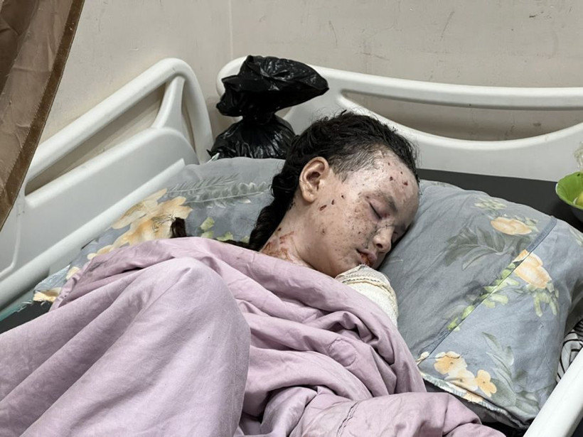 İsrail ordusunun Gazze'deki saldırısında Filistinli küçük kız bu halden bu hale geldi - Resim: 1