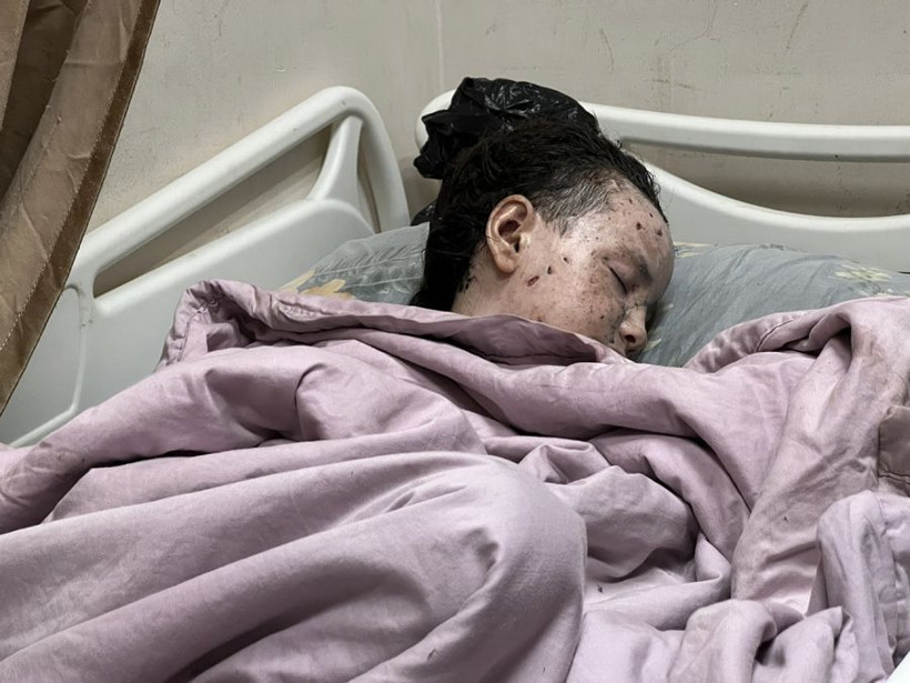 İsrail ordusunun Gazze'deki saldırısında Filistinli küçük kız bu halden bu hale geldi - Resim: 4