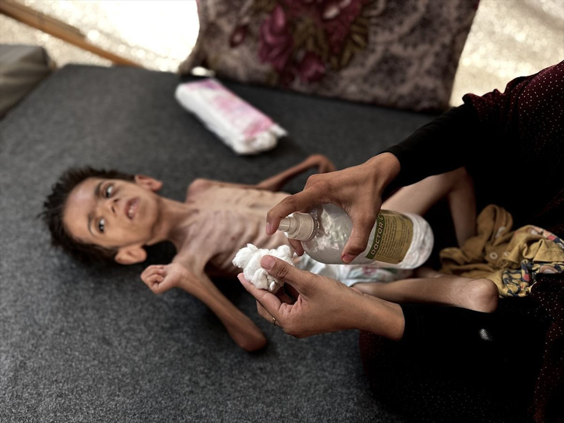 Gazze'den kahreden görüntüler! 6 yaşındaki Kerim yaşam mücadelesi veriyor - Resim: 1