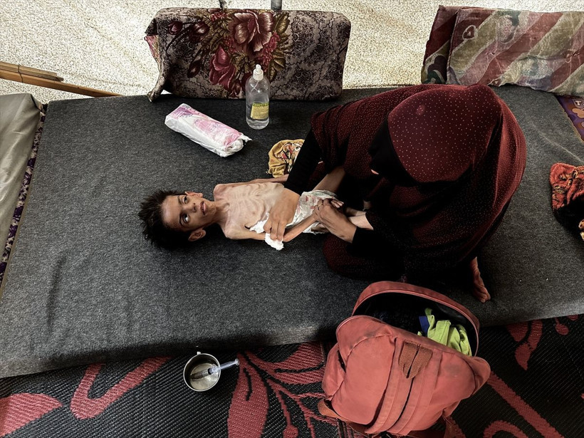 Gazze'den kahreden görüntüler! 6 yaşındaki Kerim yaşam mücadelesi veriyor - Resim: 3