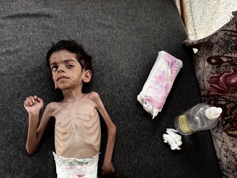 Gazze'den kahreden görüntüler! 6 yaşındaki Kerim yaşam mücadelesi veriyor - Resim: 4